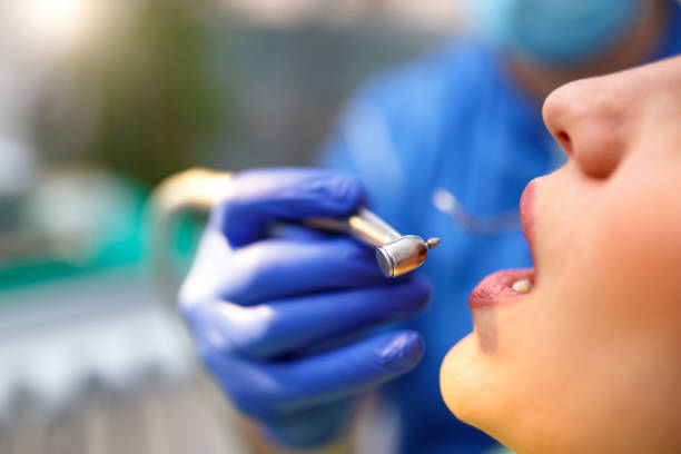 Best Teeth Whitening  in Bowling Green, MO